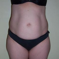 Waist Slimmer